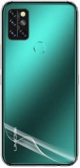 Hátsó hidrogél fólia Umidigi A9 Pro